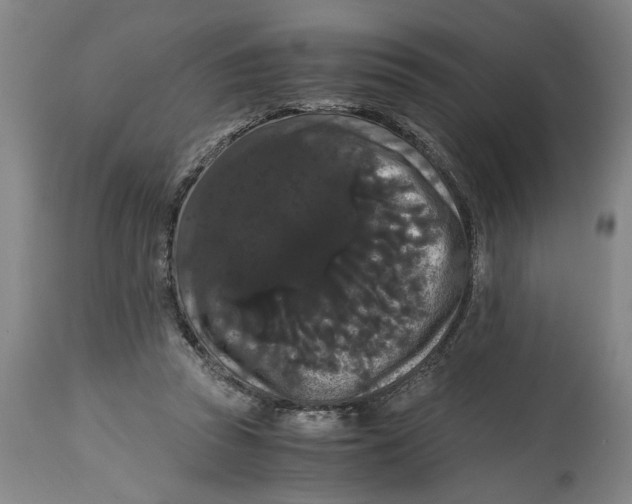 X0000114620353200911171102