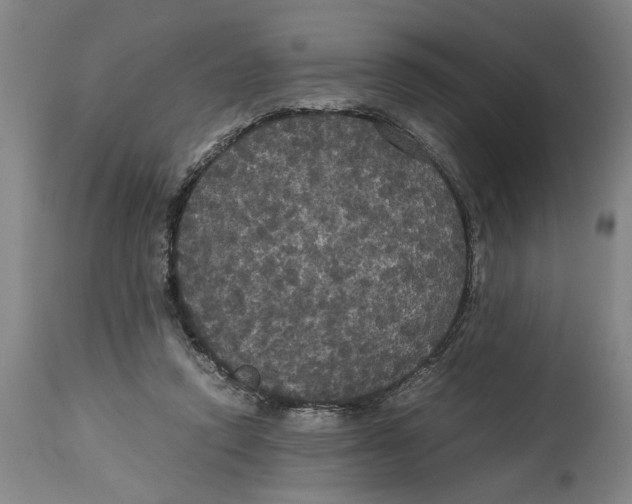 X0000114620354200911171102