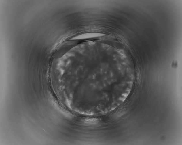 X0000114620357200911171103