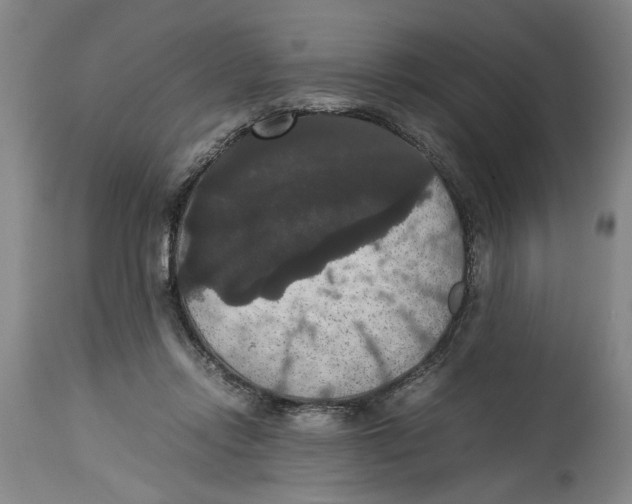 X0000114620358200911171103