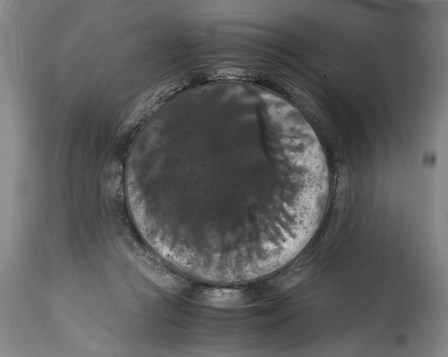 X0000114620361200911171103