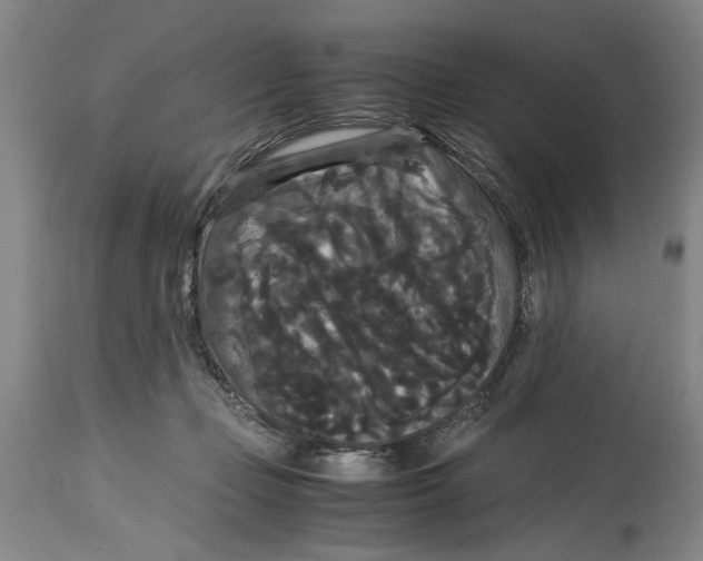 X0000114620365200911171103