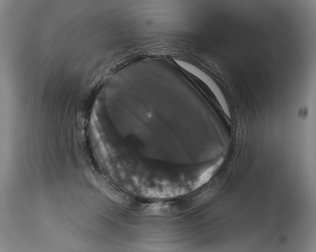 X0000114620366200911171103