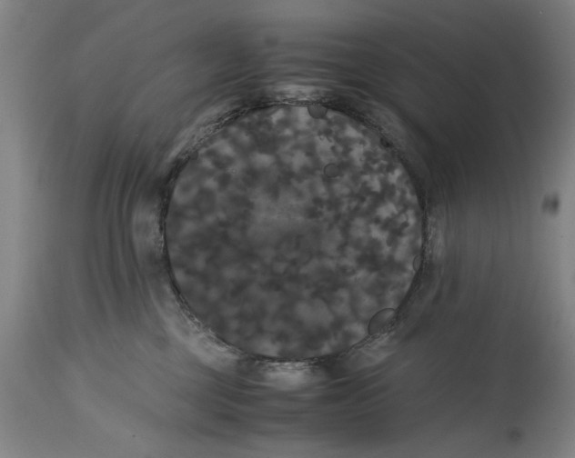 X0000114620377200911171103