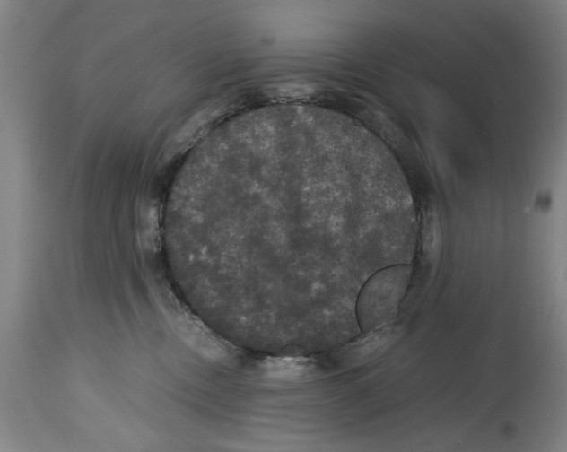 X0000114620378200911171103