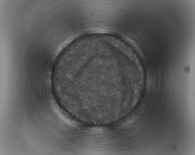 X0000114620394200911171102