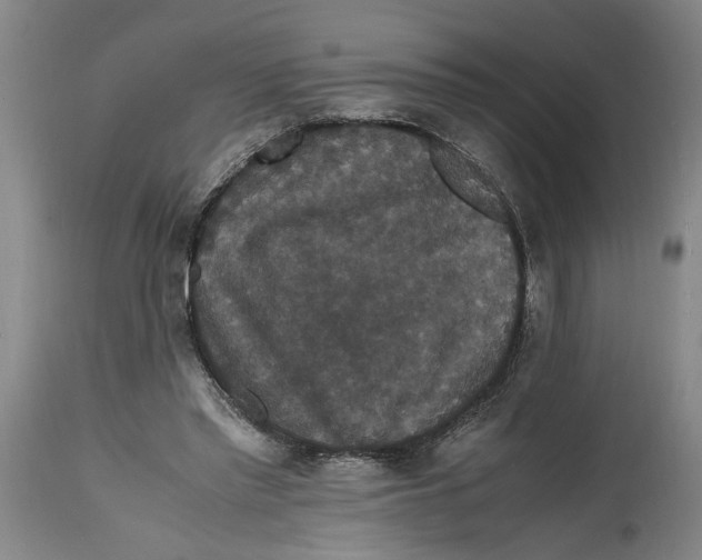 X0000114620397200911171102