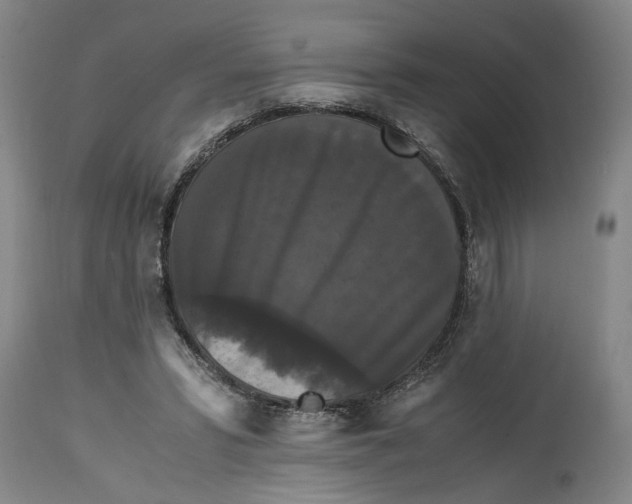 X0000114620399200911171102