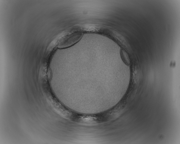 X0000114620407200911171102