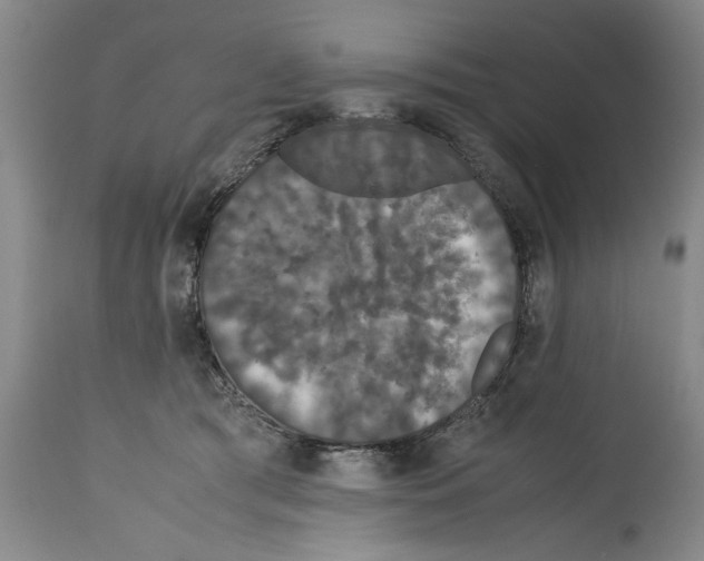 X0000114620417200911171102