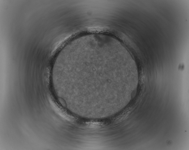 X0000114620448200911171101