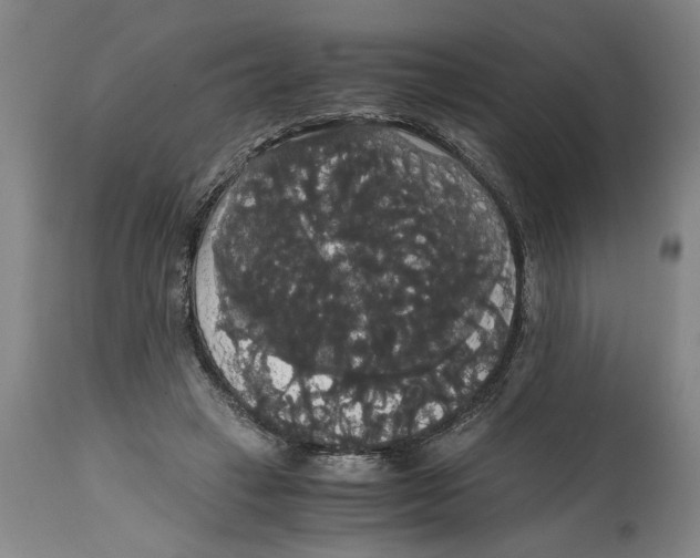 X0000114620449200911171101