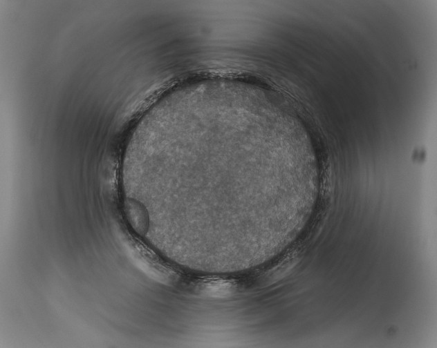 X0000114620456200911171101