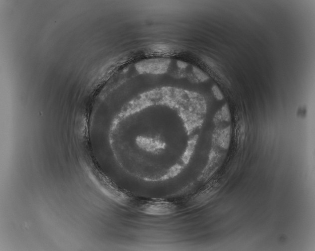 X0000114620459200911171101