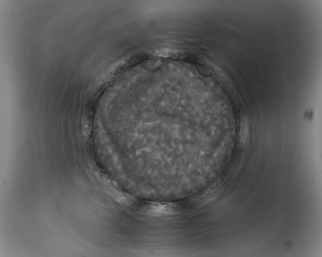 X0000114620569200911171100