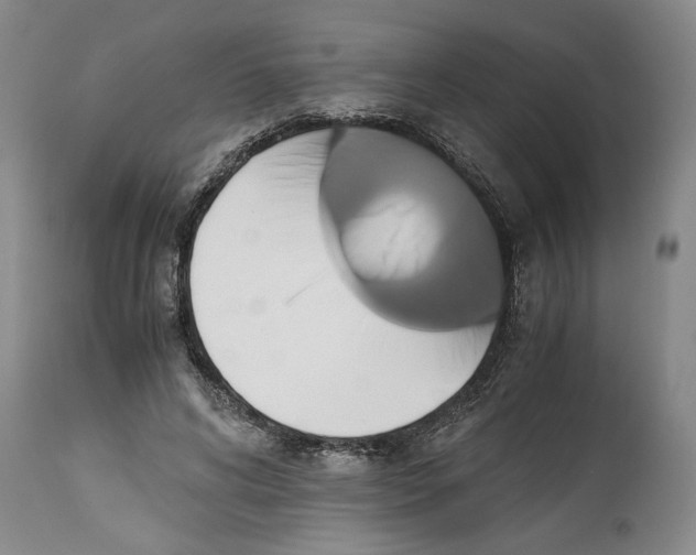 X0000114620592200911171059