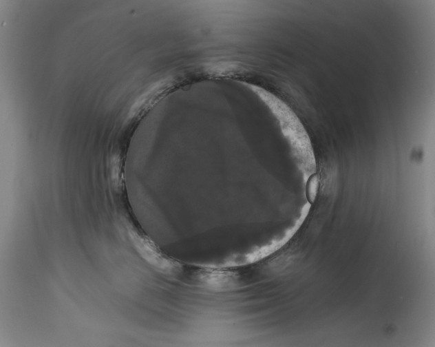 X0000114620670200911171058