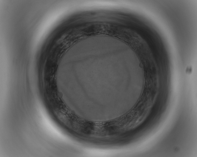 X0000114620766200911171057