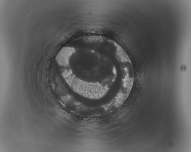 X0000114620817200911171055