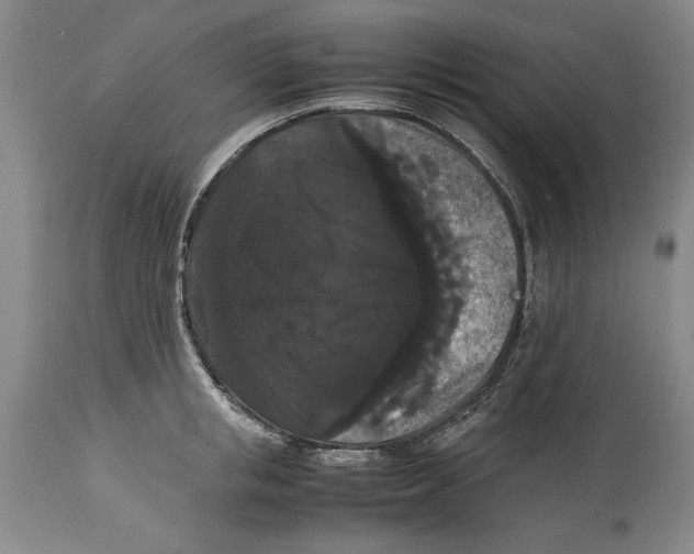 X0000114620853200911171056