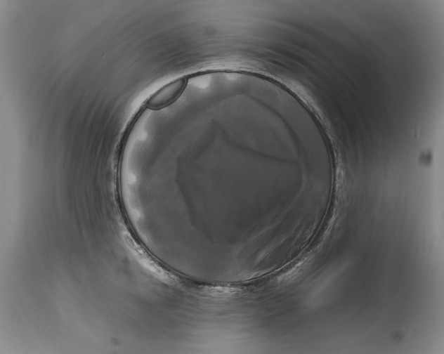 X0000114620854200911171056