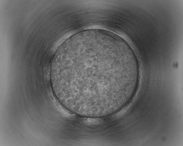 X0000114620857200911171056