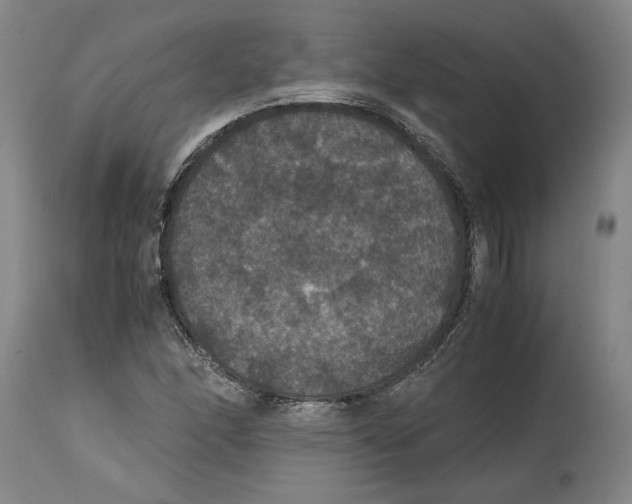 X0000114621166200911171051