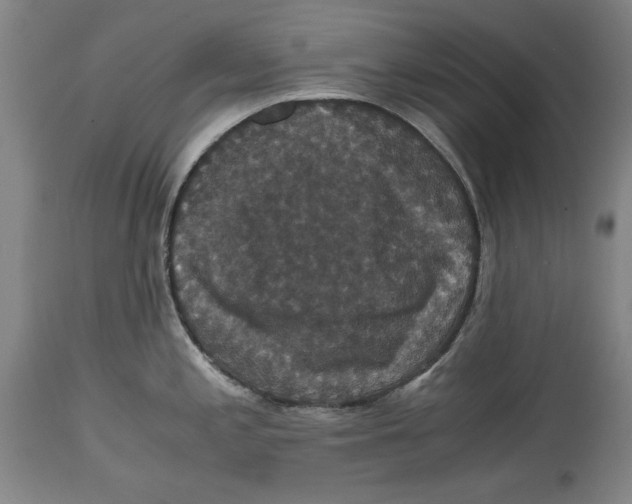 X0000114621197200911171051