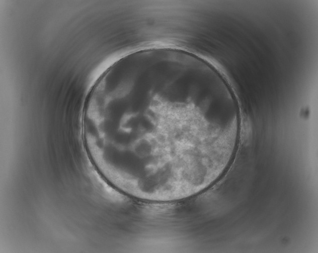 X0000114621294200911171049