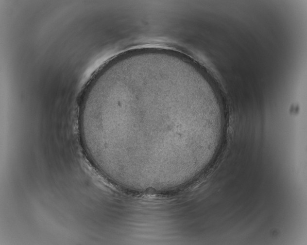 X0000114621360200911171048