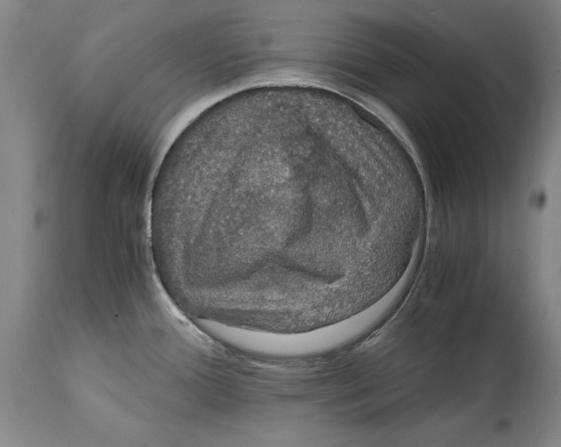 X0000114621388200911171048