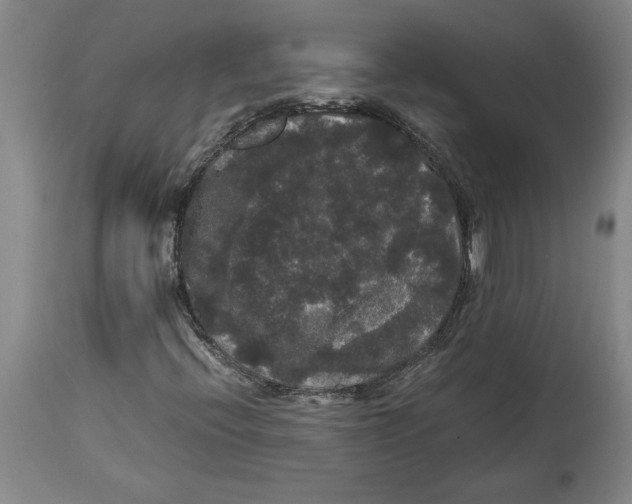 X0000114621396200911171047