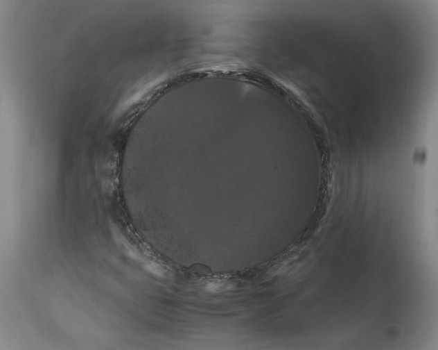 X0000114621399200911171047