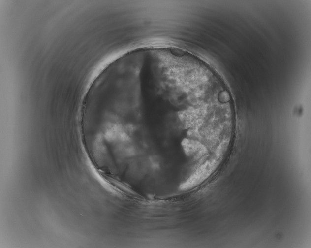 X0000114621429200911171048
