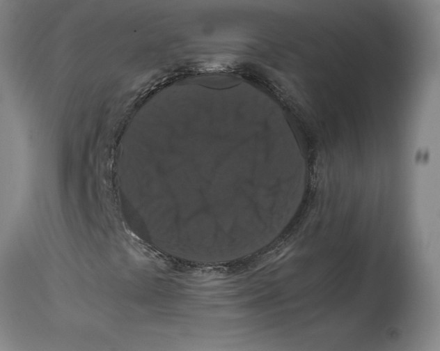 X0000114621441200911171047