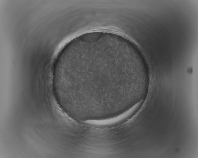 X0000114621506200911171046