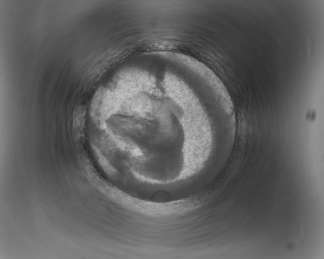 X0000114620030200912011012