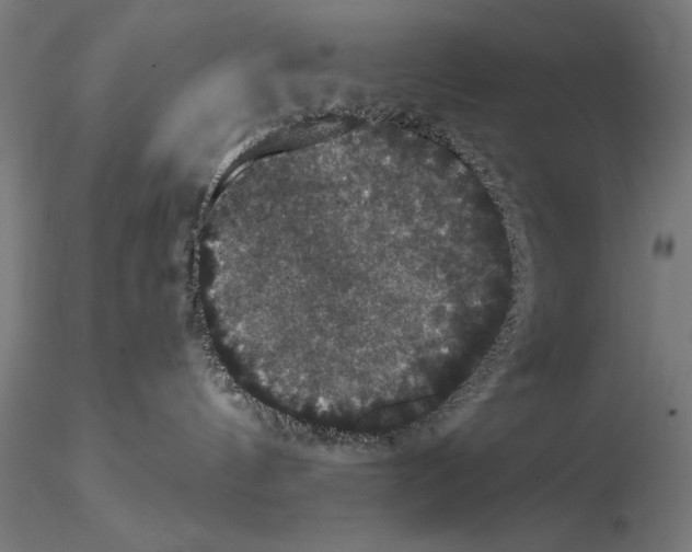 X0000114620144200912011010