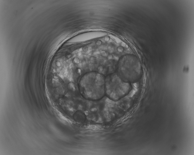 X0000114620145200912011009