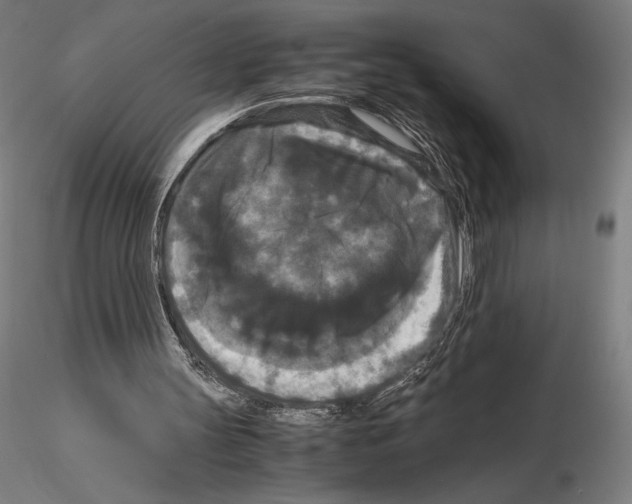 X0000114620147200912011009