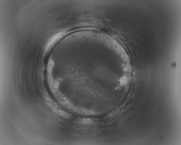 X0000114620149200912011009