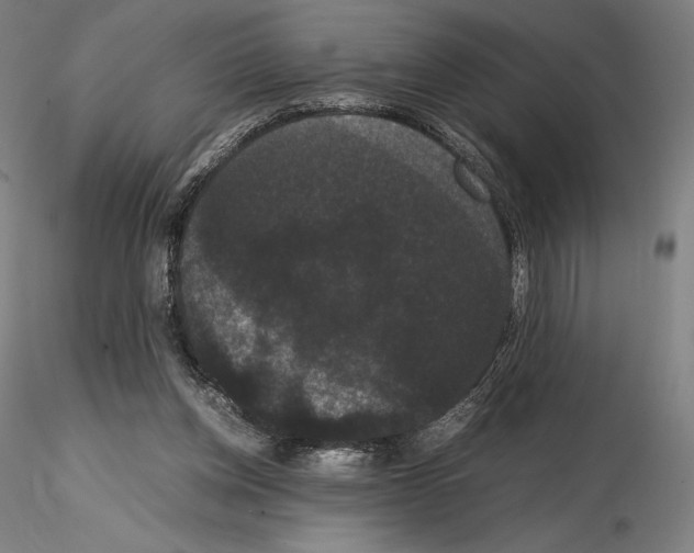 X0000114620158200912011009