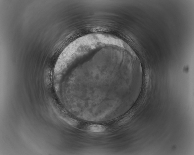 X0000114620169200912011010