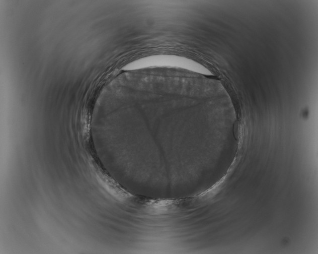 X0000114620186200912011010