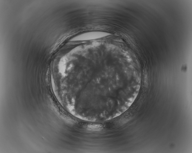 X0000114620357200912011006