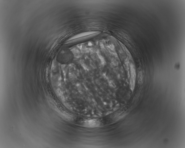 X0000114620365200912011006