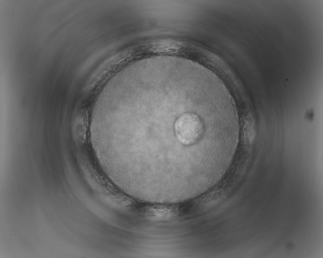 X0000114620370200912011006