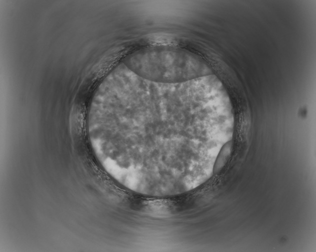 X0000114620417200912011005