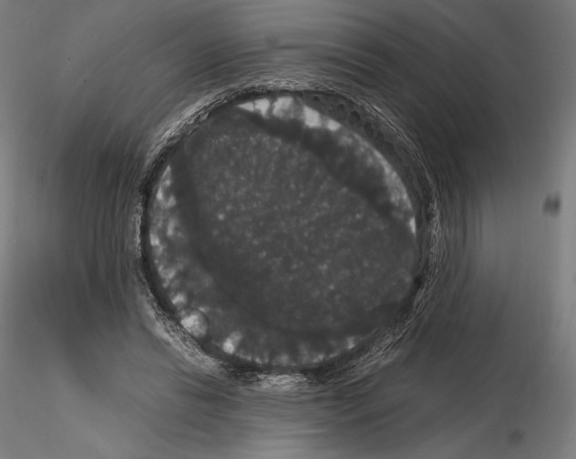 X0000114620446200912011005