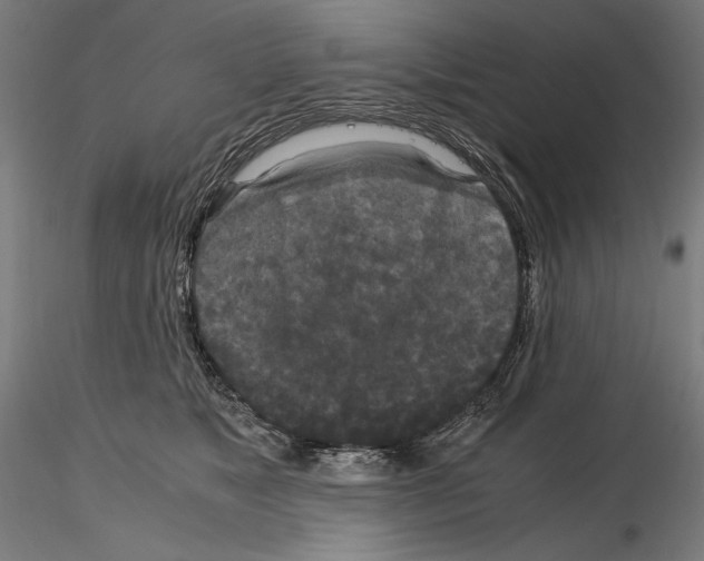 X0000114620517200912011004